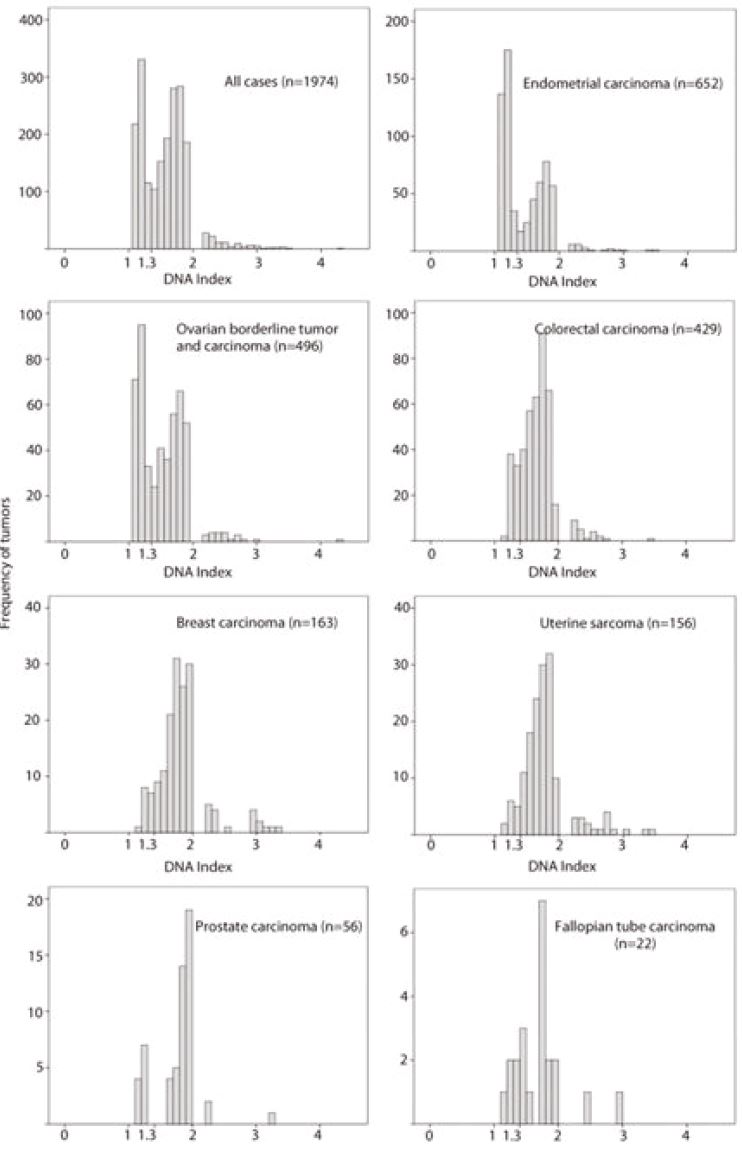 Histograms showing bimodal distribution of DNA index in anuploid tumours