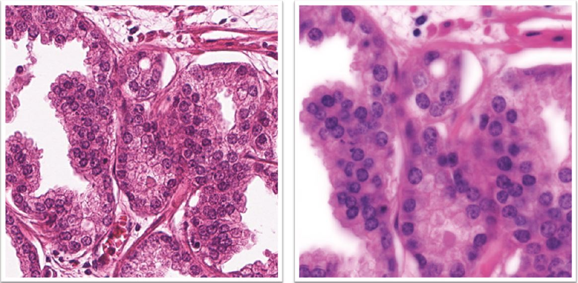 HiRes - a high-resolution scanner. Scanner examples @icgi.no