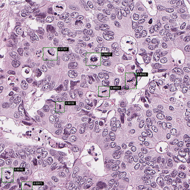 mitotic index. Image from 'SeeMore' analysing CRC and identifying mitosis.