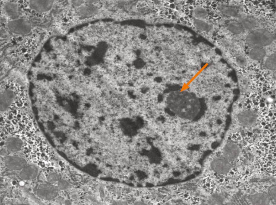 A Transmission electron micrograph of an epithelial nucleus with distinct nucleolus 